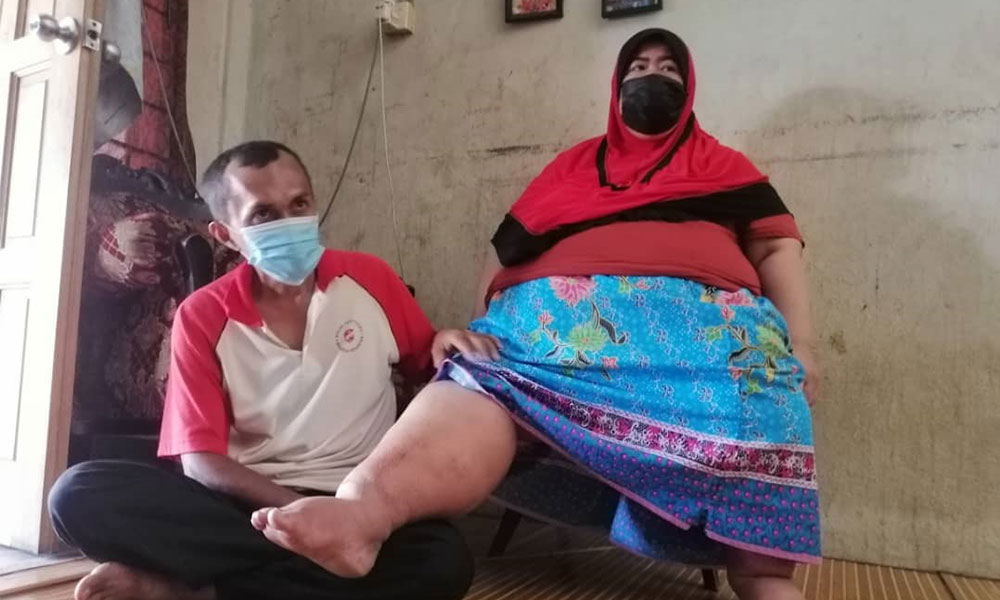 Wanita obesiti 150kg sukar bergerak, pernah koma 12 hari