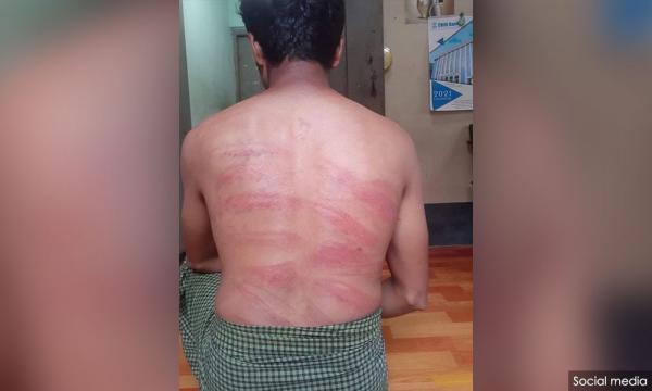 Three hours in 'hell room': Myanmar protester describes beating in custody