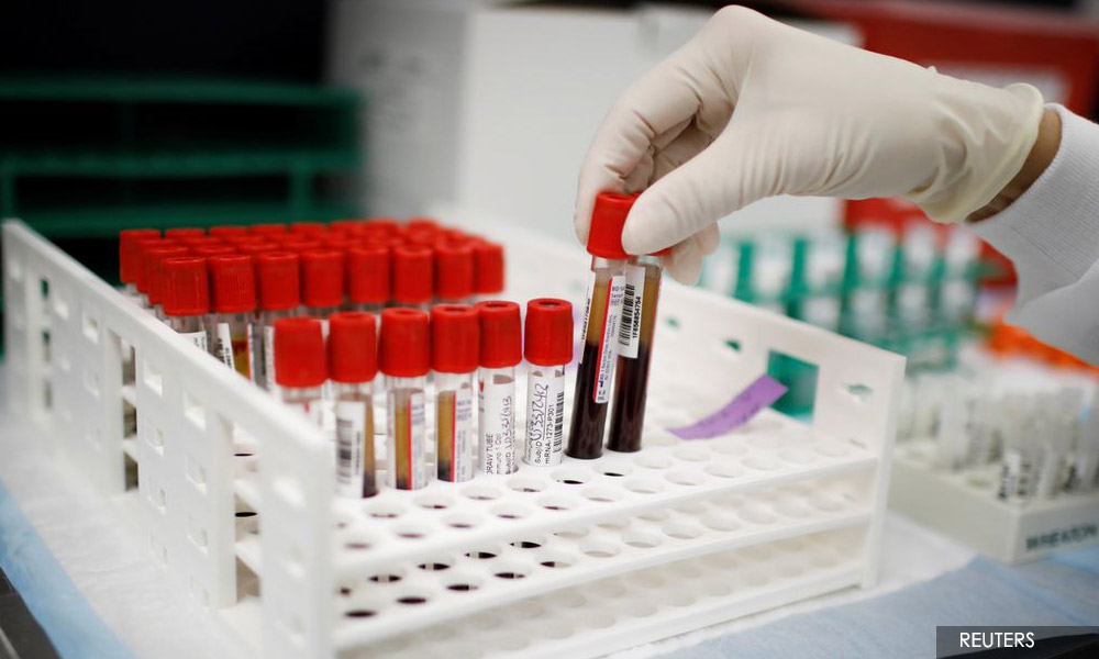 Britain begins world's largest trial of blood test for 50 types of cancer