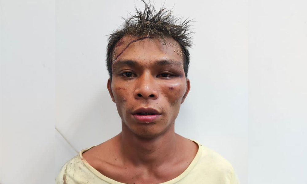 Police deny beating suspect after group alleges he was abused in custody