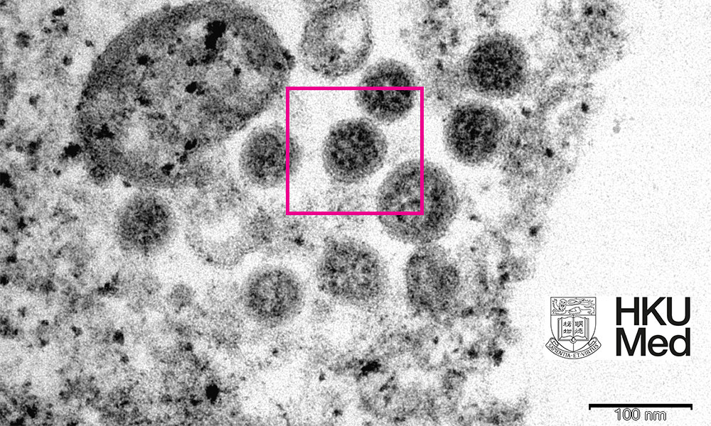 South Africa study suggests Omicron enhances immunity to Delta