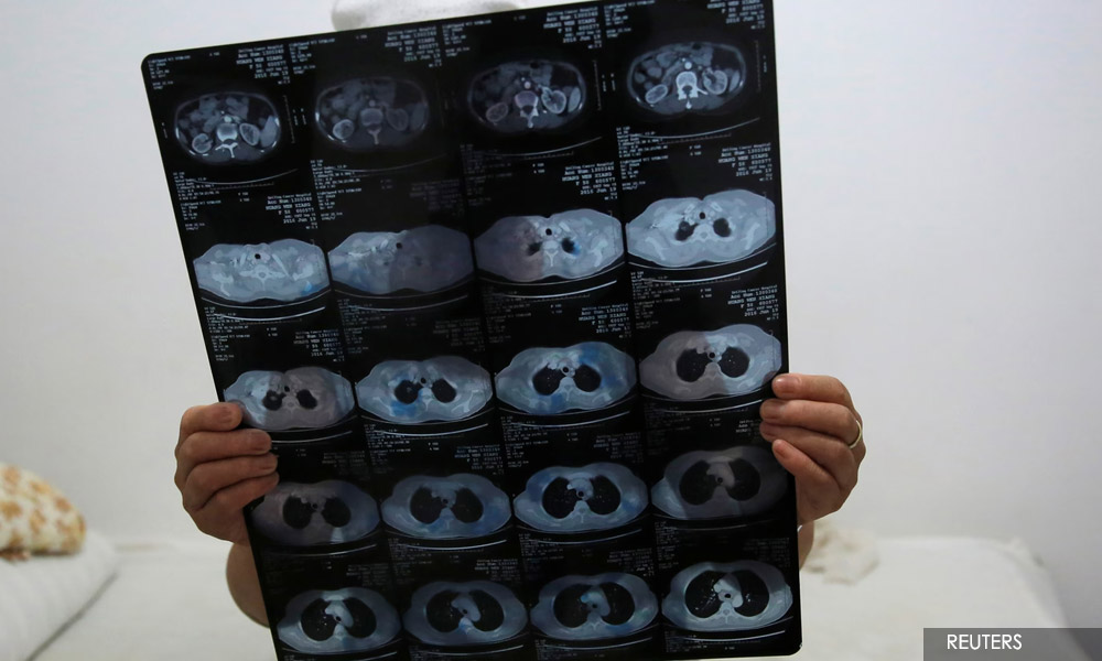 LETTER | Healthy diet can prevent cervical cancer, protect against HPV